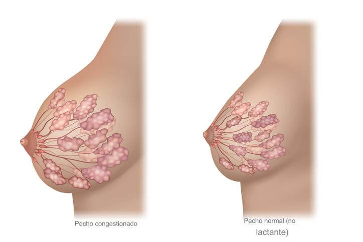 Cambios en el pecho de la embarazada
