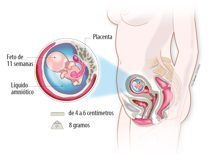 Embarazo Semana 11 Se Ven Los Genitales Del Bebe Natalben
