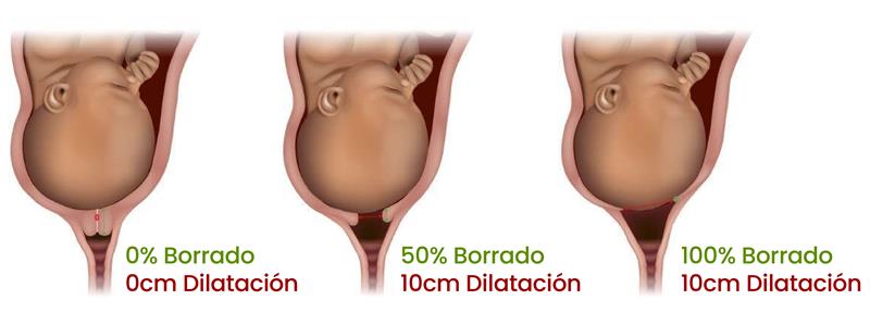 El proceso del parto